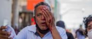 Homem fica cego de olho atingido por bala de borracha da PM em ato contra Bolsonaro